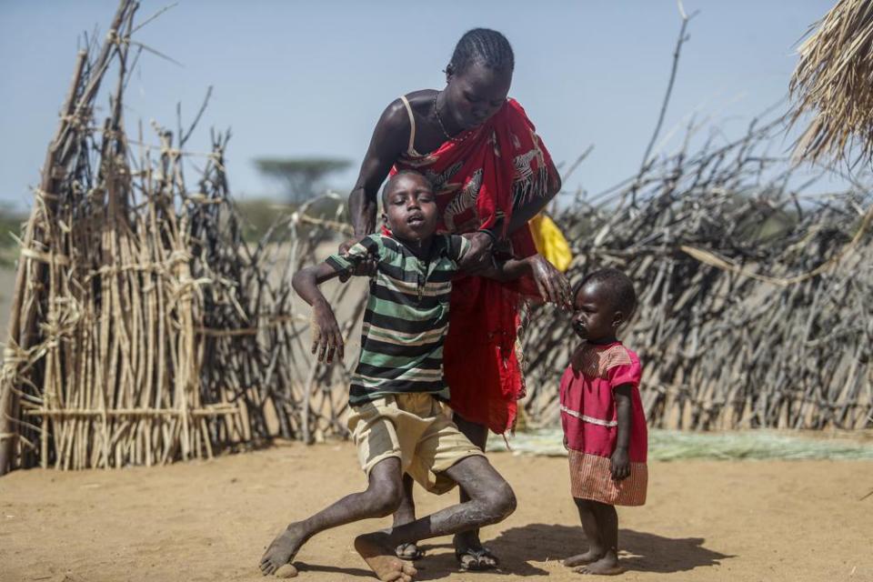 A mother helps her malnourished son stand after he collapsed near their hut in the village of Lomoputh in northern Kenya, Thursday, May 12, 2022. (AP Photo/Brian Inganga)