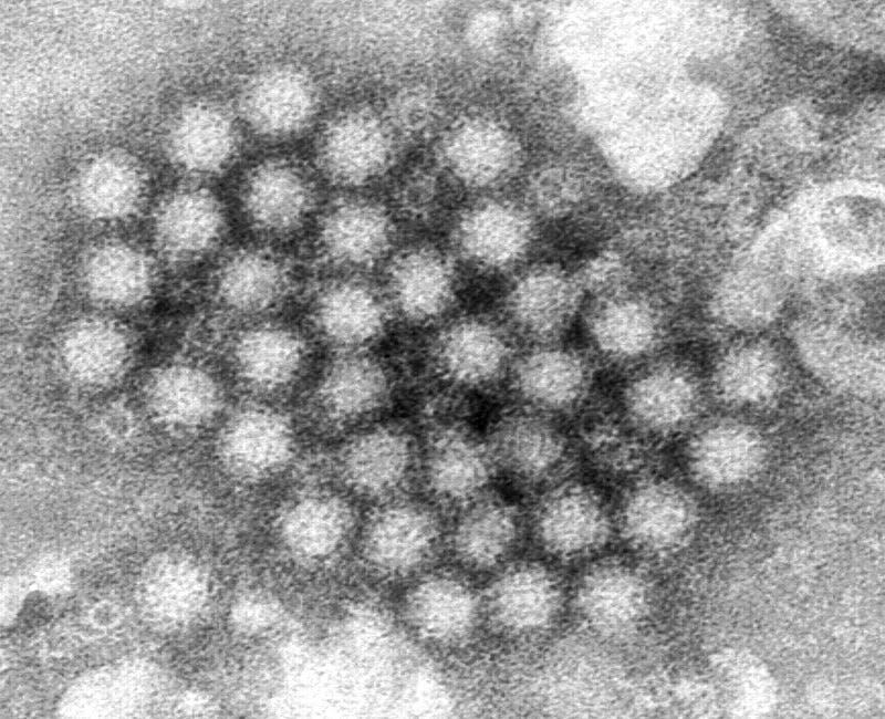 An electron microscope image of norovirus particles. - Image: Centers for Disease Control and Prevention (AP)