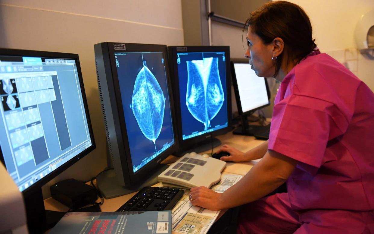 A patient has a breast ultrasound to screen for cancer - AFP