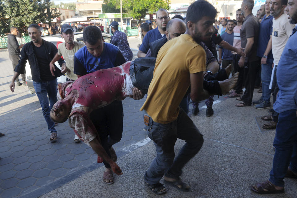 Palestinian wounded in Israeli bombardment is brought to a hospital in Deir el-Balah, Gaza Strip, Wednesday, Oct. 18, 2023. (AP Photo/Adel Hana)