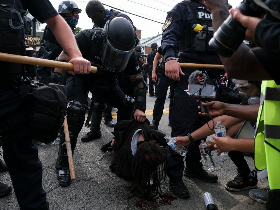 <p>A BLM protestor is detained while bleeding from the head in downtown Louisville, on September 23, 2020</p>AFP via Getty Images