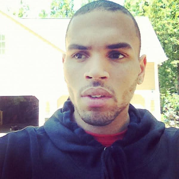 chris brown face after the fight