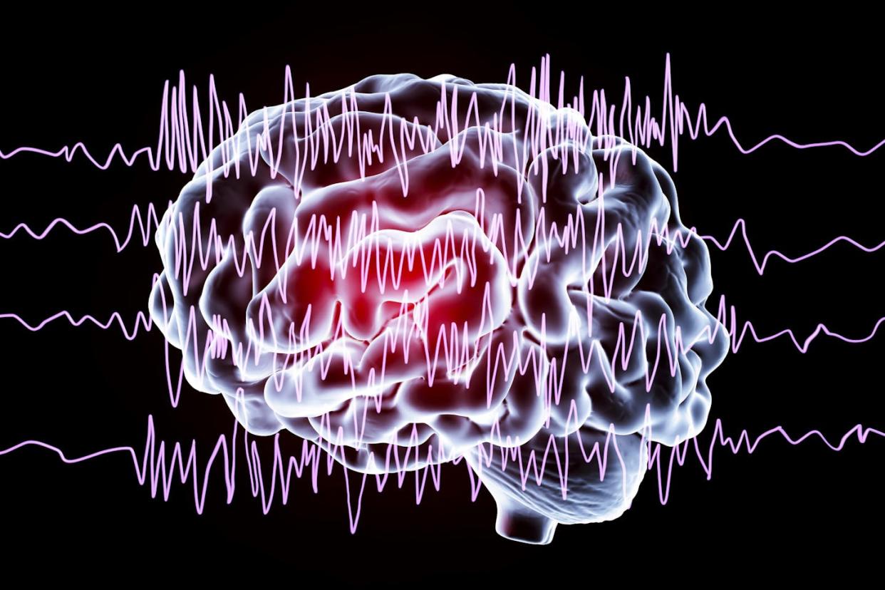 Brain waves emblematic of generalized epilepsy. <a href="https://www.gettyimages.com/detail/illustration/brain-and-brain-waves-in-epilepsy-royalty-free-illustration/973895528?phrase=EEG&adppopup=true" rel="nofollow noopener" target="_blank" data-ylk="slk:Kateryna Kon/Science Photo Library via Getty Images;elm:context_link;itc:0;sec:content-canvas" class="link ">Kateryna Kon/Science Photo Library via Getty Images</a>
