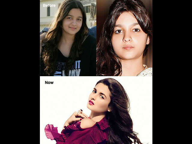 <p><b>3. Alia Bhatt </b> </p> <p> The young star of Bollywood who made her debut as a heroine with Student of the Year was not always as gorgeous as she looks now. This debutante was made to follow a strict diet under Daddy Mahesh Bhatt’s supervision for 3 months. Result? Alia was 16 Kgs lighter on screen after shedding all that puppy fat.</p>