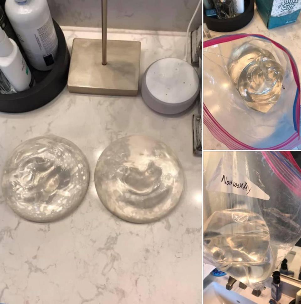 A Texas woman posted her old breast implants on Facebook Marketplace. (Photo: Facebook)