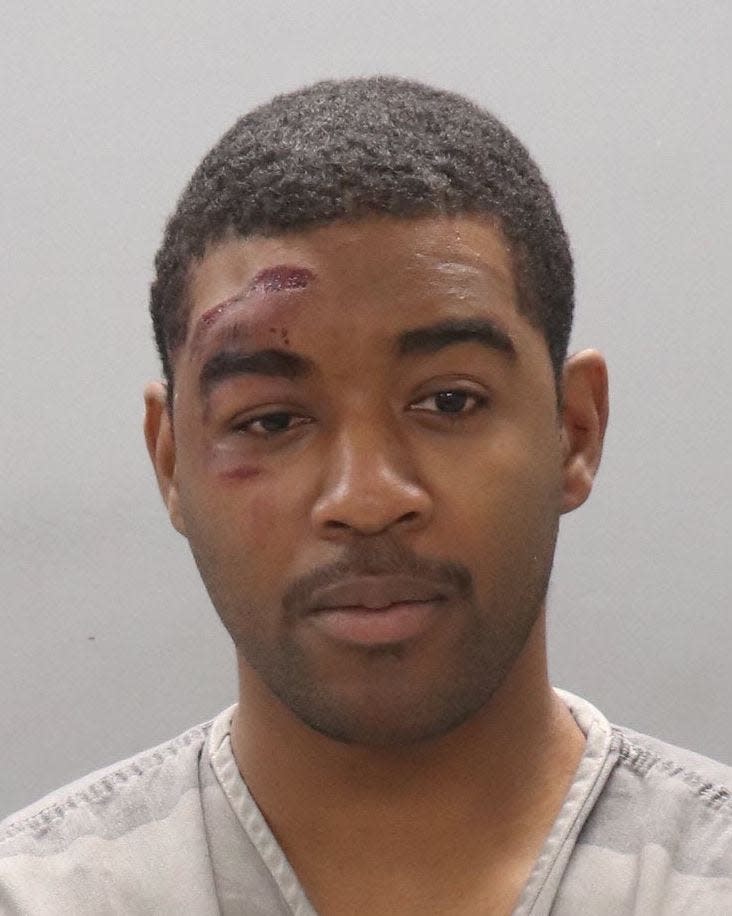 Knox News does not typically publish jail mugshots, but will in some case like this to show injuries suffered by a person during an arrest. Deep cuts are visible on the Starbucks shift manager's face and forehead.