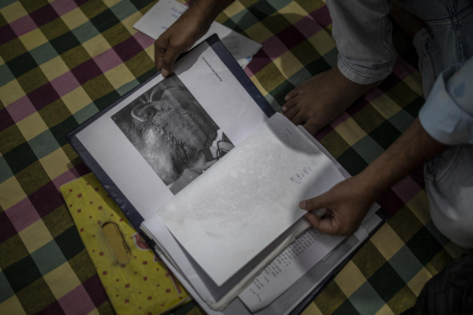 Muhammad Nasir Khan, who was shot by a Hindu mob during the February 2020 communal riots, sifts through his legal and medical files inside his home in North Ghonda, one of the worst riot affected neighborhood, in New Delhi, India, Friday, Feb. 19, 2021. As the first anniversary of bloody communal riots that convulsed the Indian capital approaches, Muslim victims are still shaken and struggling to make sense of their struggle to seek justice. (AP Photo/Altaf Qadri)