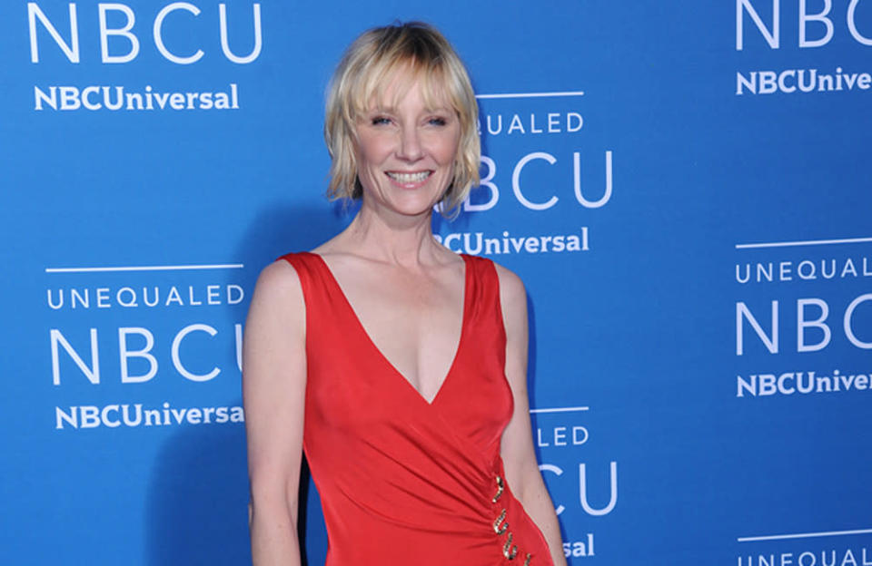Anne Heche has been left severely burned and intubated in hospital after a fiery car crash credit:Bang Showbiz