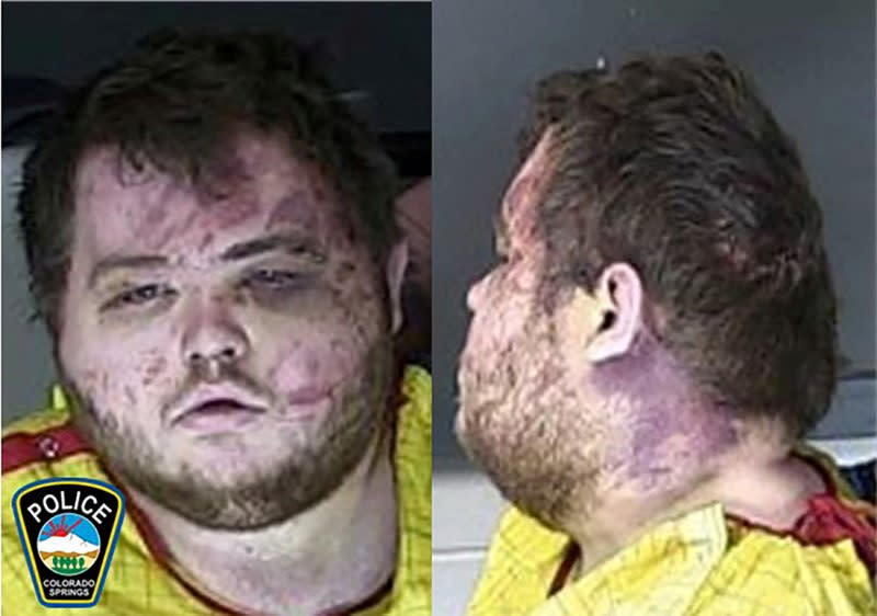 FILE PHOTO: Mass shooting suspect Anderson Lee Aldrich appears in police booking photograph