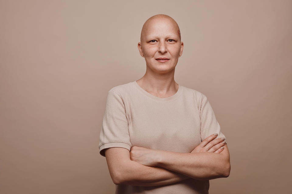 Warm-toned waist up portrait of bald woman with alopecia