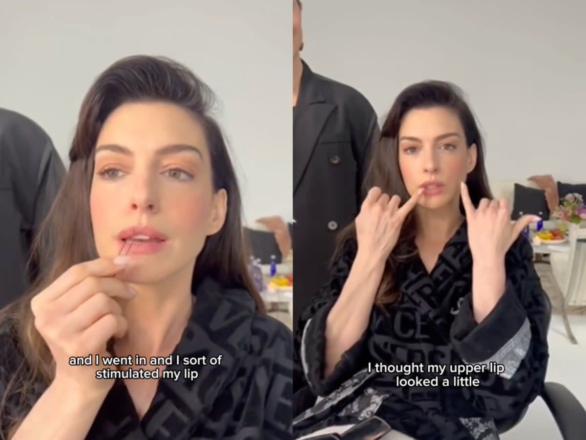 Anne Hathaway’s savvy use of hair pins to plump lips goes viral (@annehathaway/TikTok)