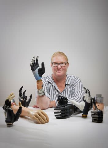 <p>SWNS</p> Karin, 50, of Sweden photographed with her new bionic arm