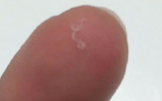 Adult Thelazia gulosa removed from the eye of human on a person’s finger - Centre for Disease control and Prevention