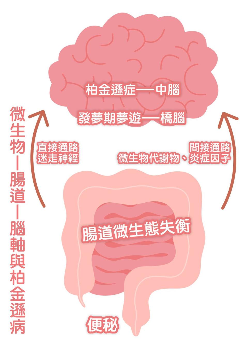 腸道 腸道微生態 柏金遜症 發夢期夢遊