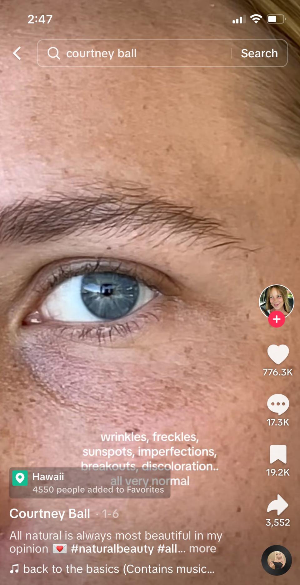 Close-up showing fine lines and freckles around Courtney's eye