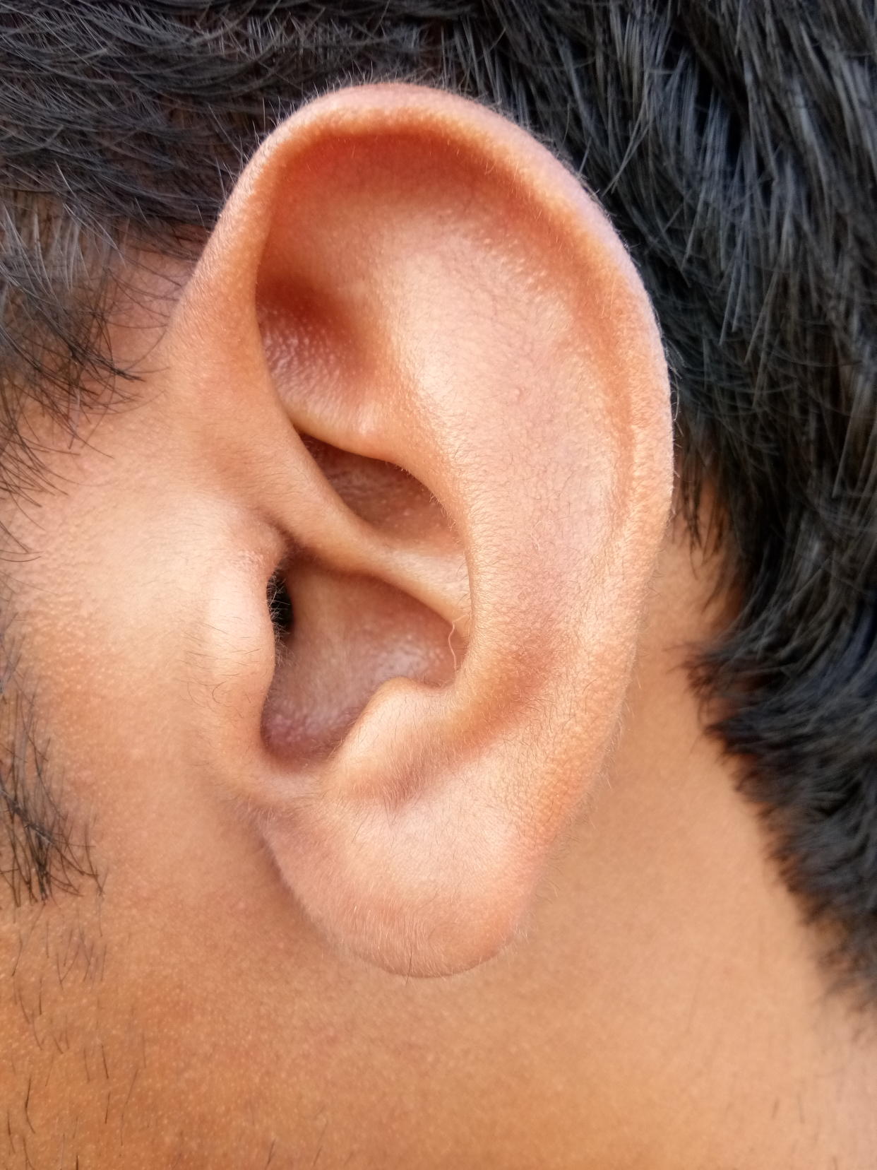 A Swedish body modification artist performed a “conch removal” procedure. (Photo: Getty Images)