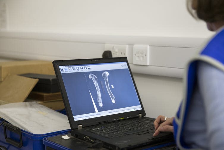 <span class="caption">Professor Sandra Corr checking radiographs.</span> <span class="attribution"><span class="source">University of Nottingham</span></span>