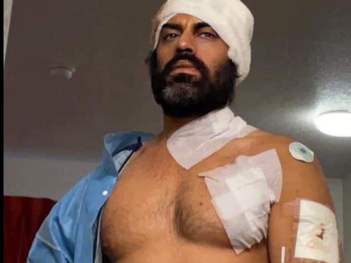 Aman Dhaliwal, a Bollywood actor, shows off his wounds after a man attacked him with a knife and a hatchet outside a Planet Fitness in Corona, California (Facebook/Arman Dhaliwal)