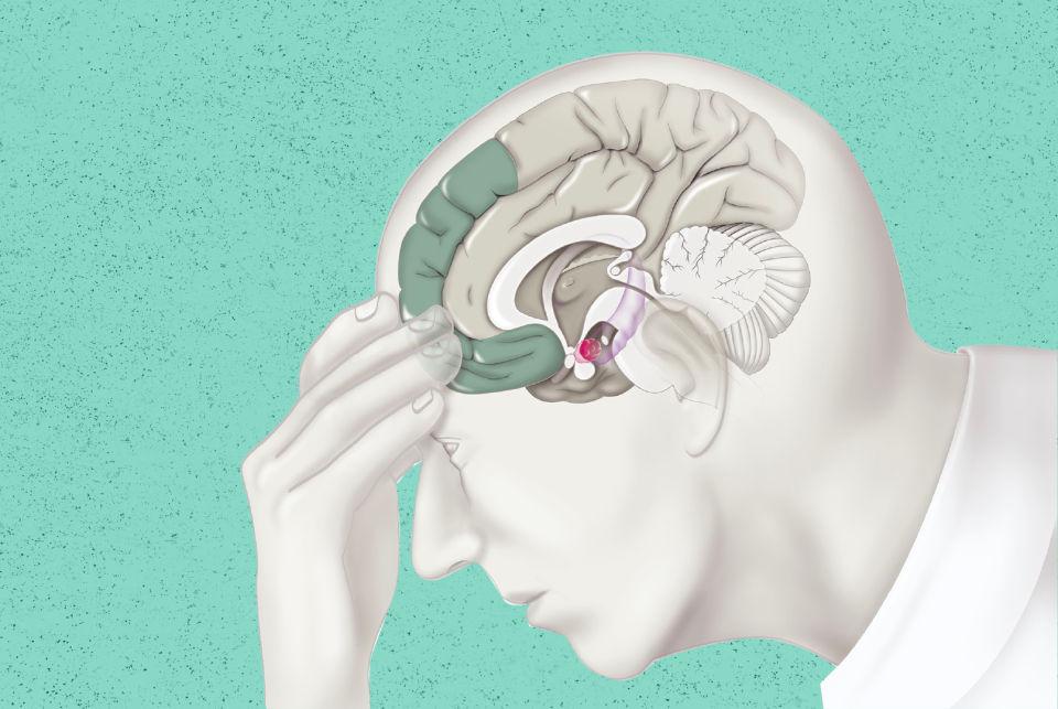 Le problème ne se situe pas aux niveaux de ces hormones mais bien au niveau du cortex préfrontal et dans les régions cingulaires antérieures dorsales du cerveau.