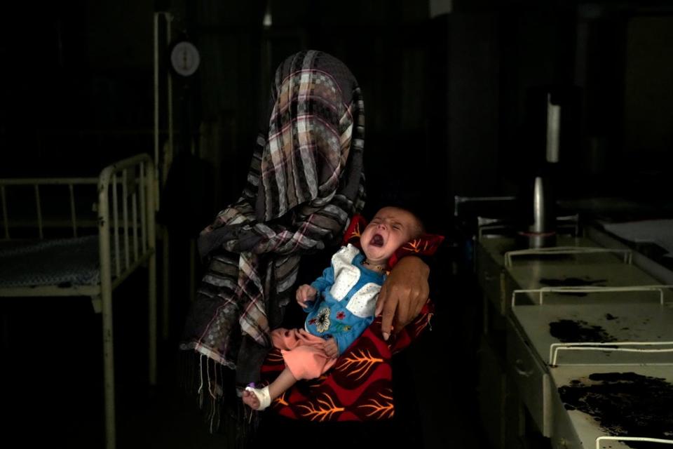 AFGANISTAN DESNUTRICION (AP)