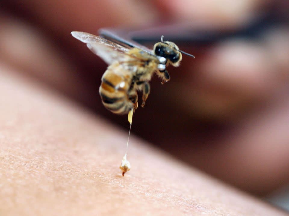 A Spanish woman died after having repeated bee acupuncture sessions. Photo: Getty