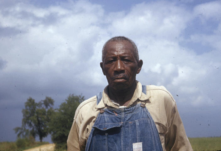 This 1950's photo made available by the National Archives shows a man included in a syphilis study in Alabama. For 40 years starting in 1932, medical workers in the segregated South withheld treatment for Black men who were unaware they had syphilis, so doctors could track the ravages of the illness and dissect their bodies afterward. (National Archives via AP)