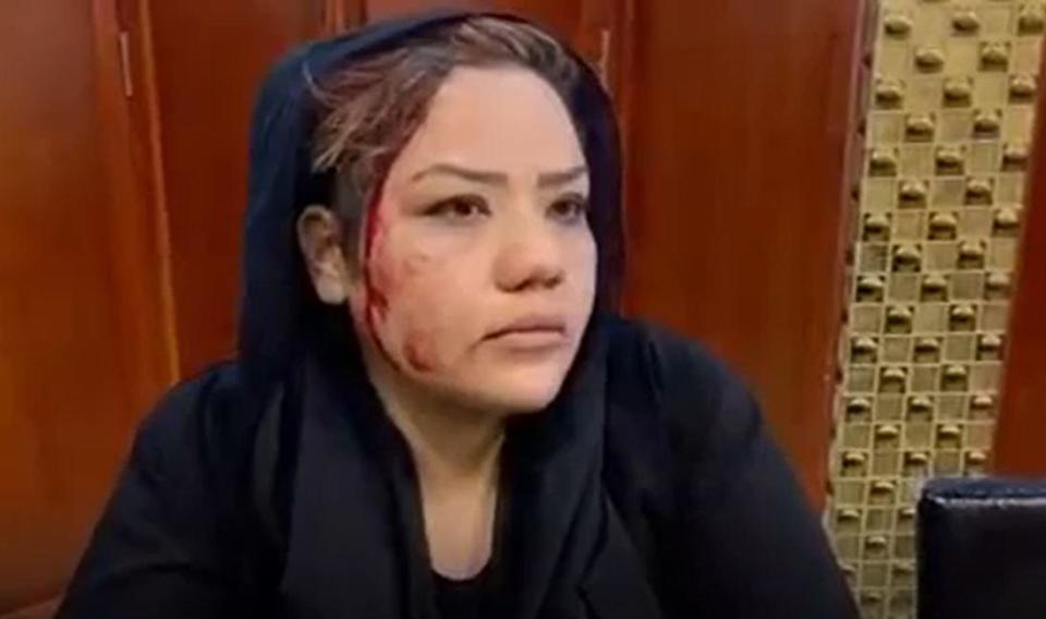 An image from a video sent to CBS News by Afghan women's rights activist Nargis Sadat shows her bleeding from her head after Taliban members attacked her during a protest in Kabul in September, 2021. 
