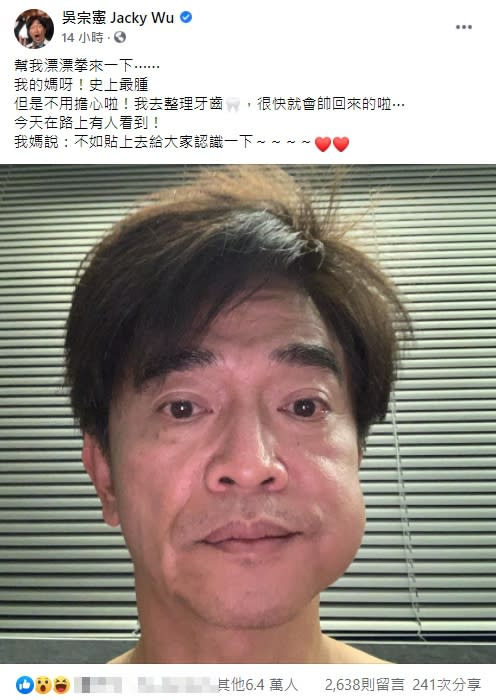 吳宗憲昨日PO出一張自己的臉腫照，吸引熱烈討論。（圖／翻攝自吳宗憲臉書）