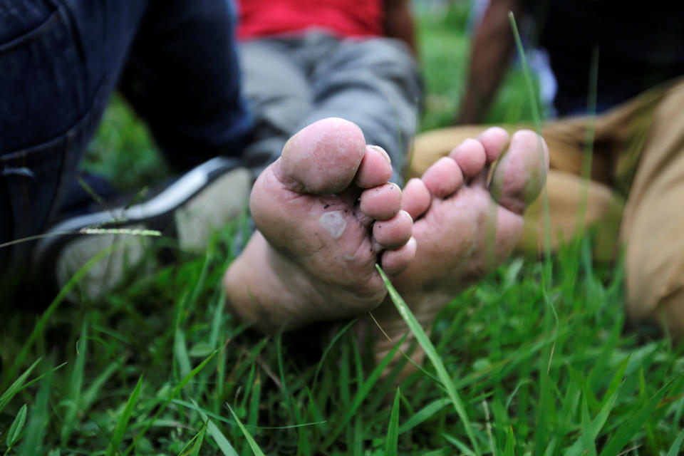 <p>Blistered feet of one of the Hondurans fleeing poverty and violence after a long walk, part of their journey in a caravan bound for the United States, in Ocotepeque, Honduras, Oct. 14, 2018. (Photo: Jorge Cabrera/Reuters) </p>