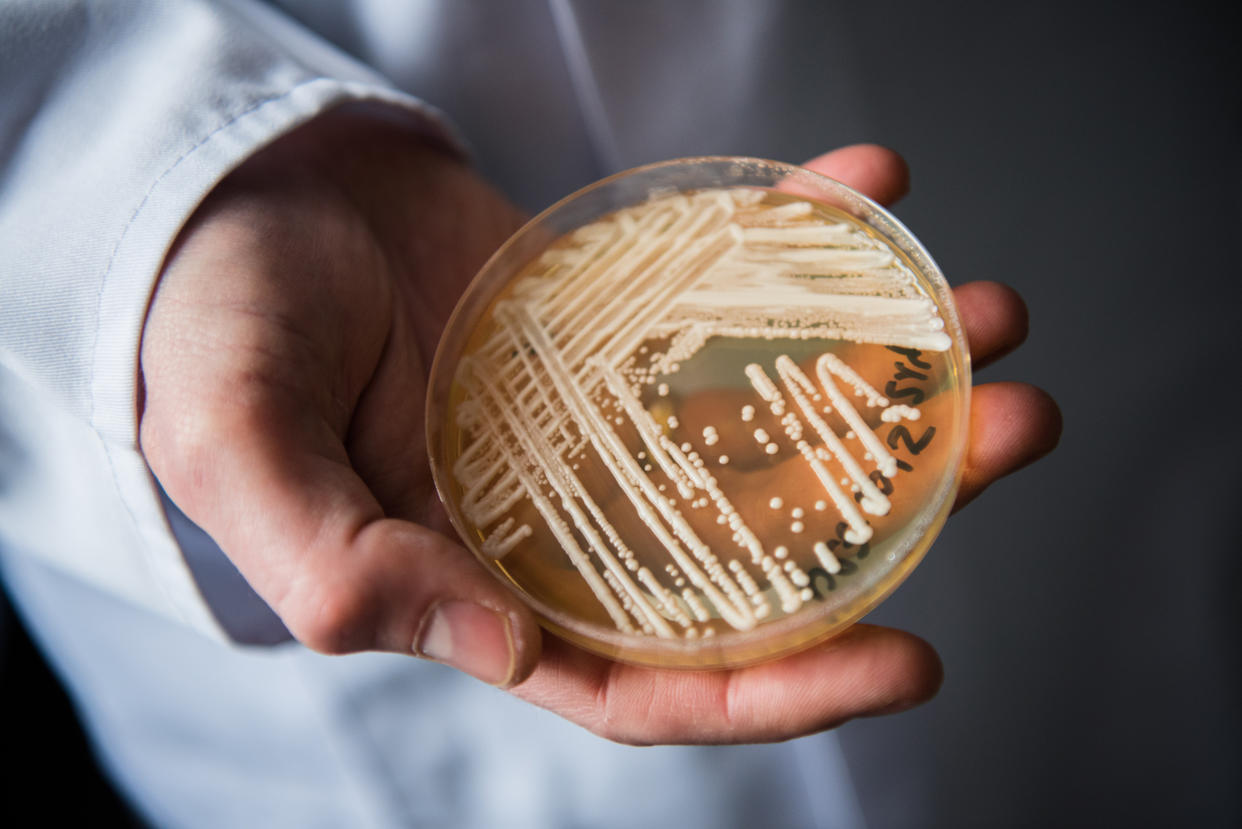 Petri dish of candida auris in a laboratory. (Getty Images)