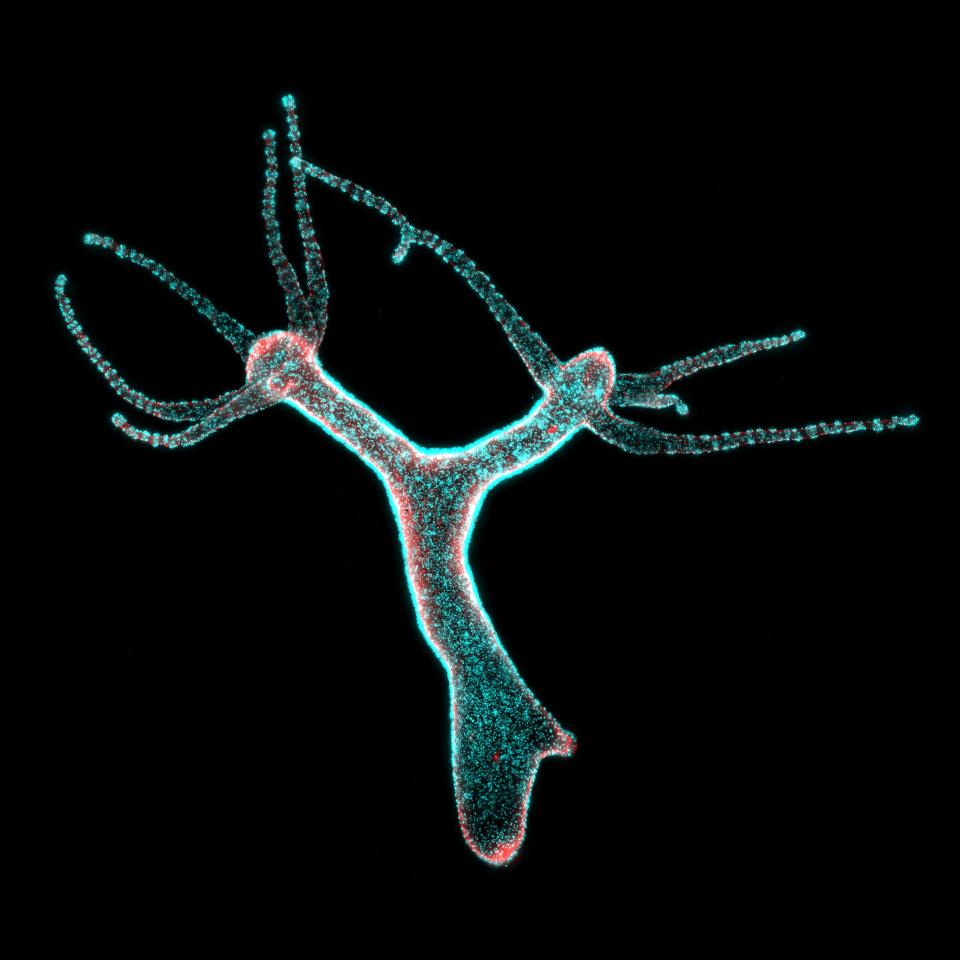 Freshwater hydra that have regenerated from single cells. Image was taken during the "Embryology Concepts & Techniques in Modern Developmental Biology" course at the Marine Biological Laboratory in Woods Hole, MA.