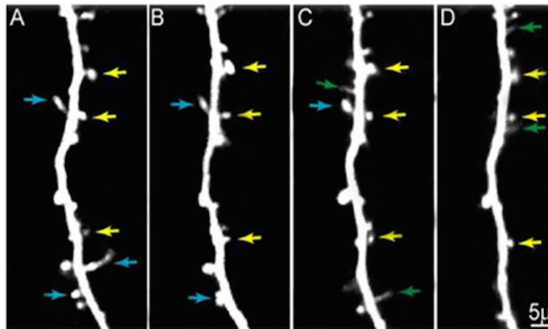 cocaine mice brain