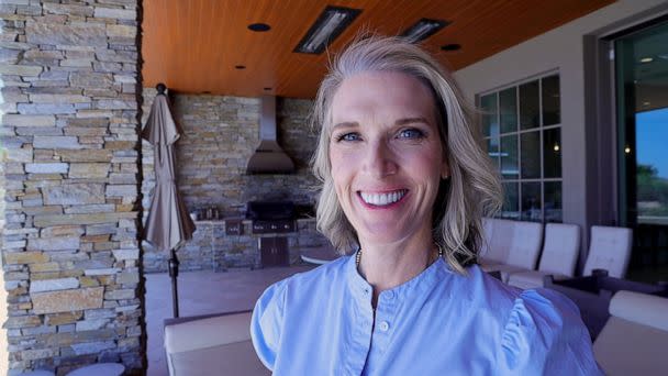 PHOTO: Alison O'Neill, of Arizona, is pictured after undergoing surgery and treatment for a cancerous tumor on her face. (Daniel O'Neill)