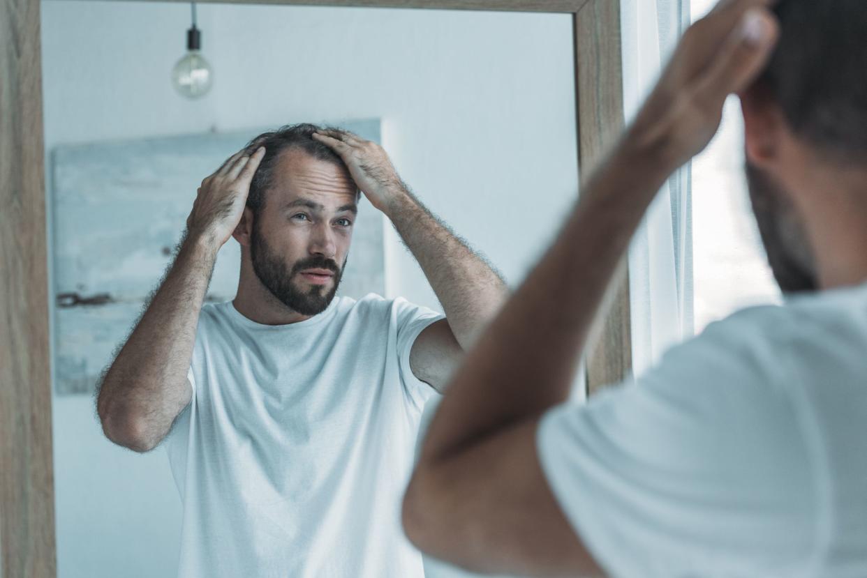 cropped shot of middle aged man with alopecia looking at mirror, hair loss concept