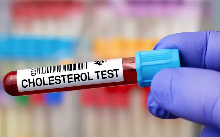 Cholesterol test