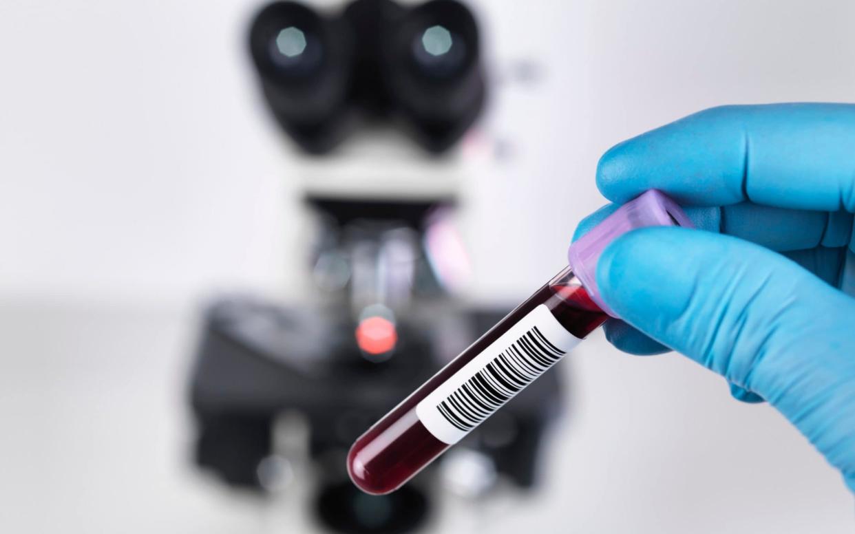 Blood tests are a first line of attack for GPs when a patient presents with symptoms - Cultura RF