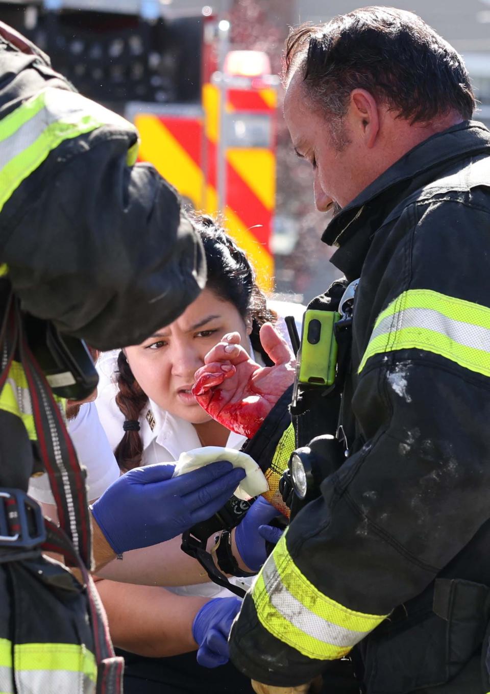 Brockton Fire Lt. Christopher Gallant injured his right hand while battling a house fire at 135 Maplewood Circle on Sunday, Aug. 14, 2022.