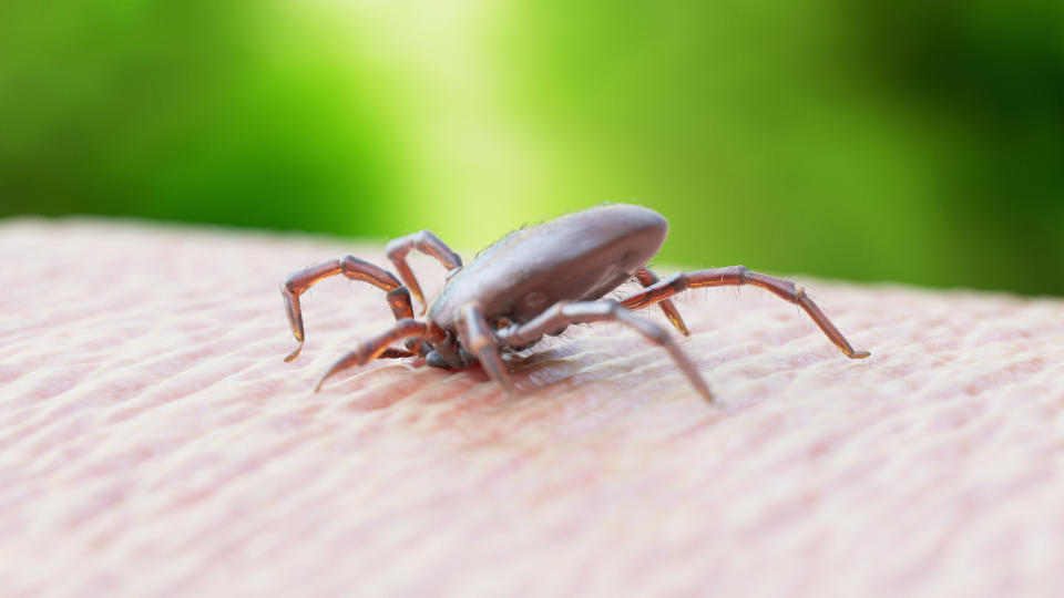 close up of a tick biting human flesh