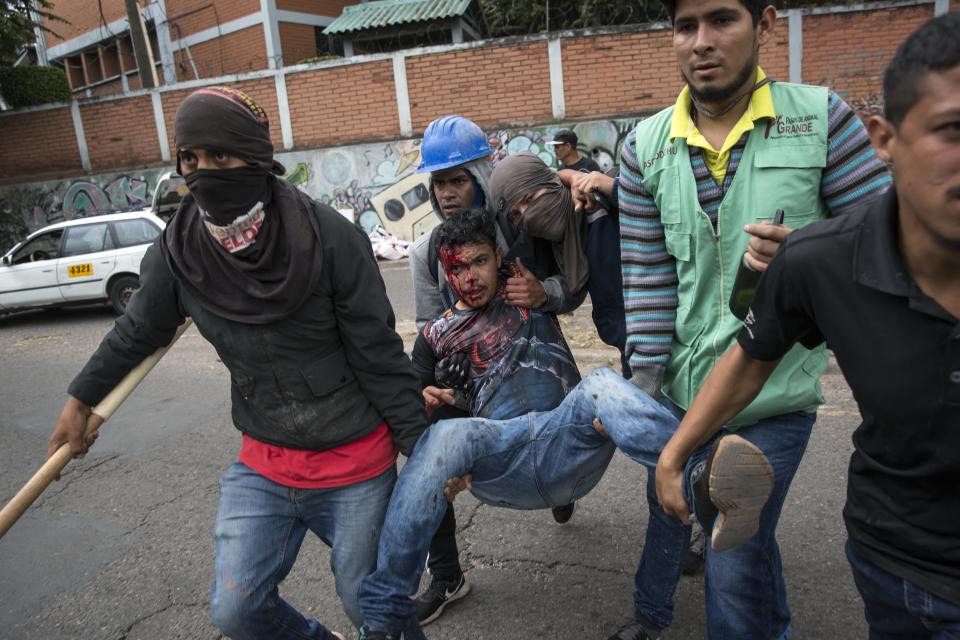 <p>A supporter of Libre Alliance presidential candidate Salvador Nasralla is assisted by fellow protesters after getting injured during clashes with security forces guarding the institute where election ballots are stored in Tegucigalpa, Honduras, Thursday, Nov. 30, 2017. (Photo: Rodrigo Abd/AP) </p>