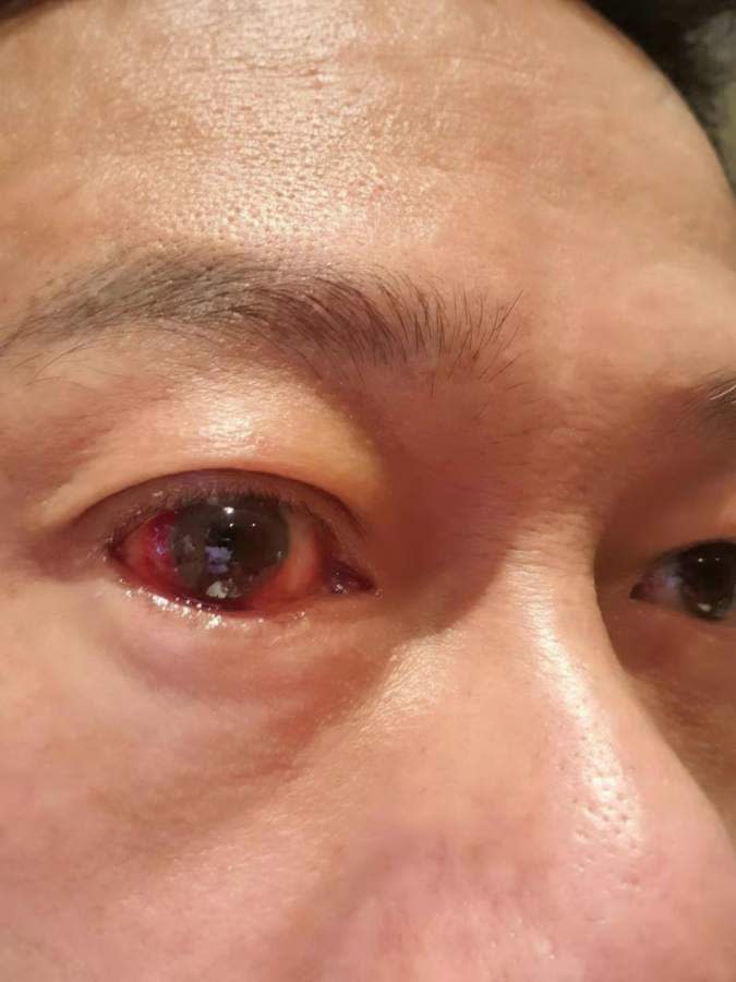 電影上映前，人在廣州的李康生，發現自己的眼睛突然充血，跟角色們中邪時的眼睛一樣。（圖／翻攝自李康生臉書）