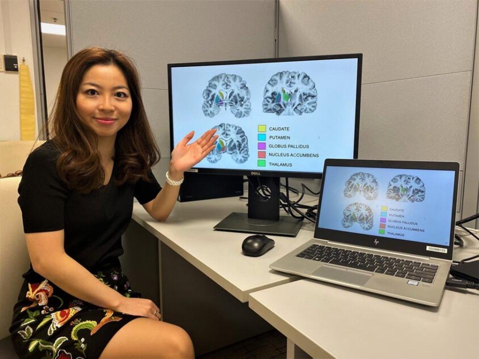 Assistant Professor Olivia Choy, a neuroscientist from NTU’s School of Social Sciences, presenting diagrams of the human striatum (NTU Singapore)