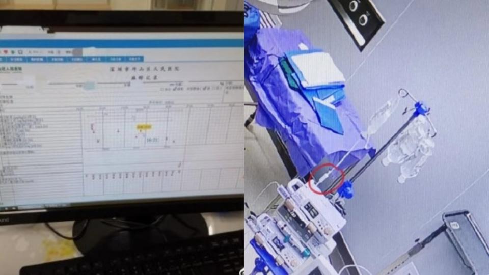 女子因麻醉效果不足清醒。 （圖／翻攝自微博）