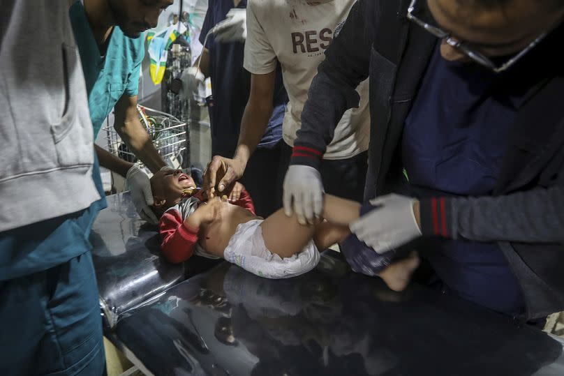 A Palestinian child wounded in the Israeli bombardment of the Gaza Strip is brought to a hospital in Rafah, May 10, 2024