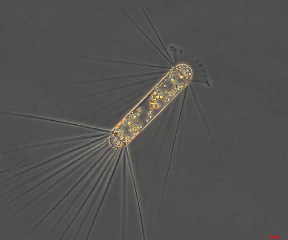 This species of diatom, <em>Corethron pennatum</em>, bloomed during the iron fertilization.