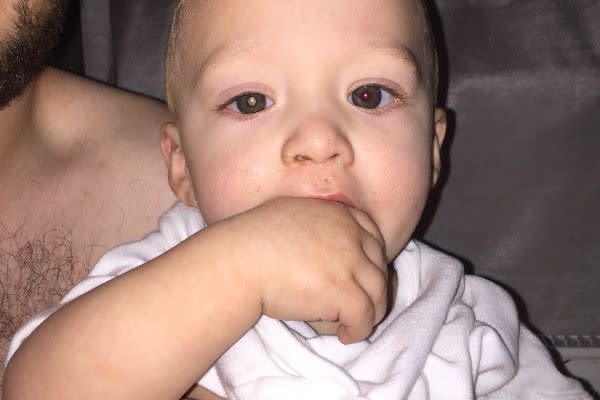 Owen Scrivens a remarqué sur cette photo que l’un des yeux de son fils était rouge, alors que l’autre révélait un reflet blanc. (Photo : GoFundMe)