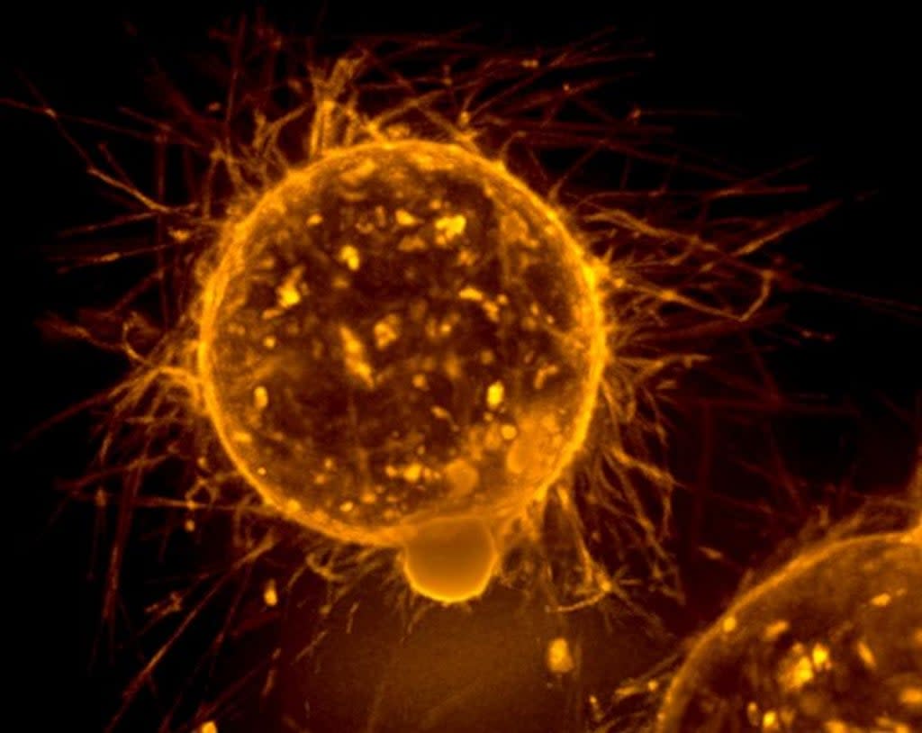 Breast tumor cell in a free-floating environment (National Cancer Institute)