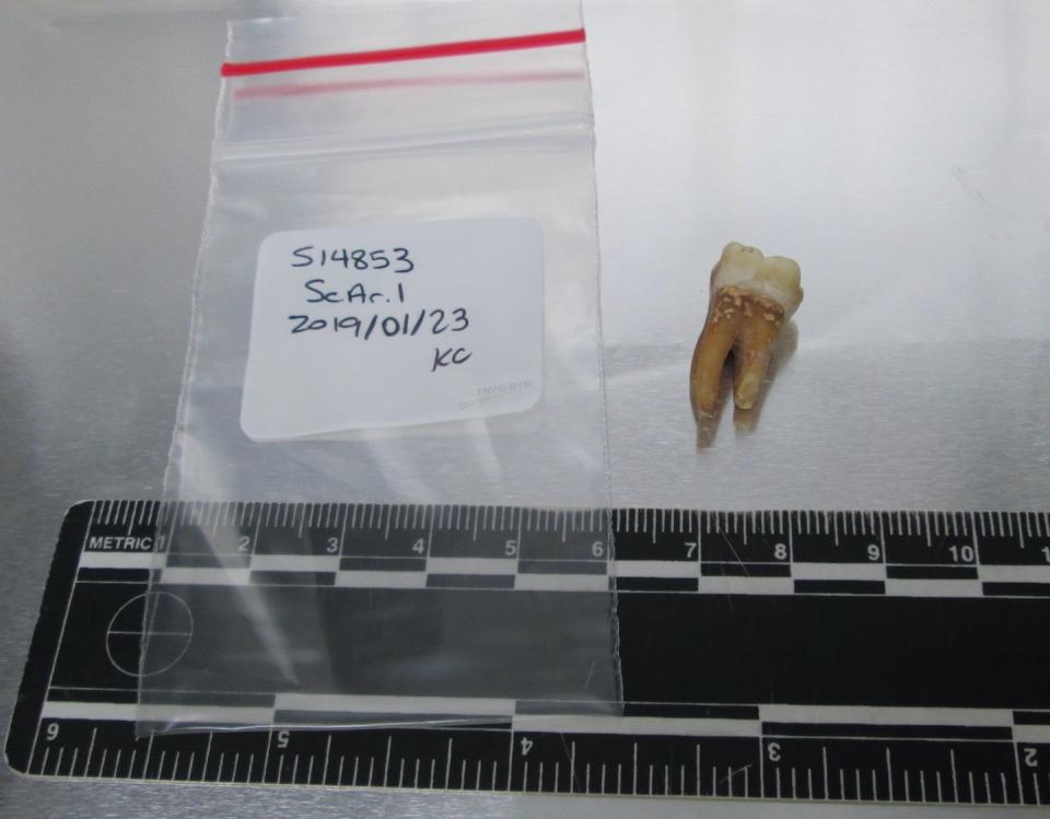 In accordance with rabbinical ruling, researchers collected DNA from teeth that were already loose in the remains of people who lived during the 1300s. David Reich/Harvard Medical School, <a href="http://creativecommons.org/licenses/by-nd/4.0/" rel="nofollow noopener" target="_blank" data-ylk="slk:CC BY-ND;elm:context_link;itc:0;sec:content-canvas" class="link ">CC BY-ND</a>