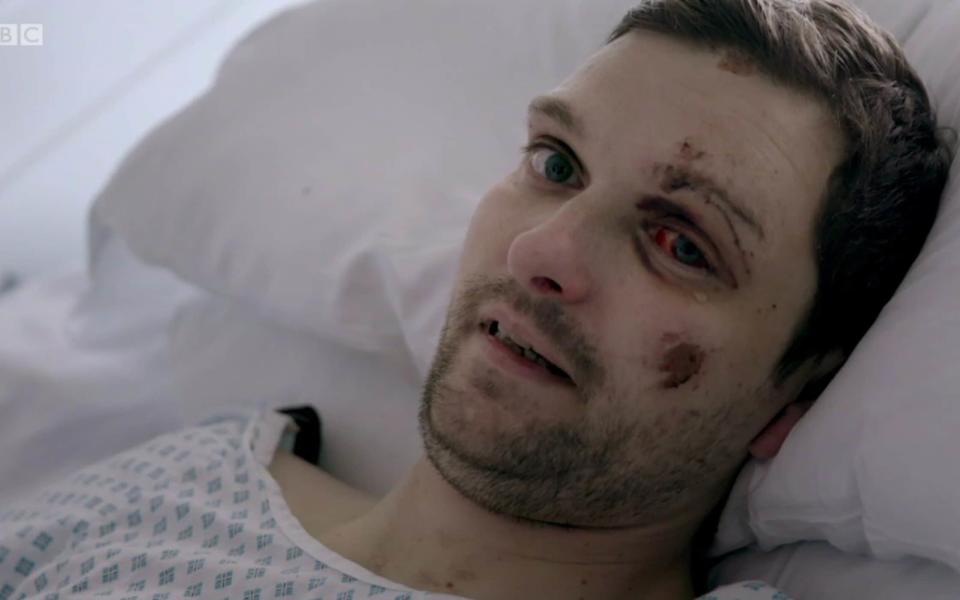 Stephen Lockwood recovering at St Mary's Hospital in Paddington, West London - Credit: BBC