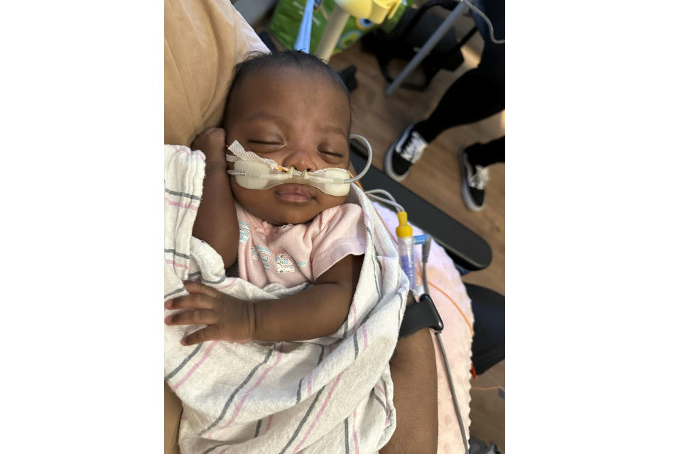 This undated photo shows 6-month-old Nyla Brooke Haywood, a baby girl born Nov. 17, 2023, at Silver Cross Hospital in New Lenox, Illinois. Nyla was born at just 22 weeks weighing 1 pound and 1 ounce, making her what’s known as a “micropreemie.” She left Silver Cross Hospital on Monday weighing a healthy 10 pounds, and was taken home by her first-time parents, NaKeya and Cory Haywood of Joliet, Illinois. (NaKeya Haywood via AP)