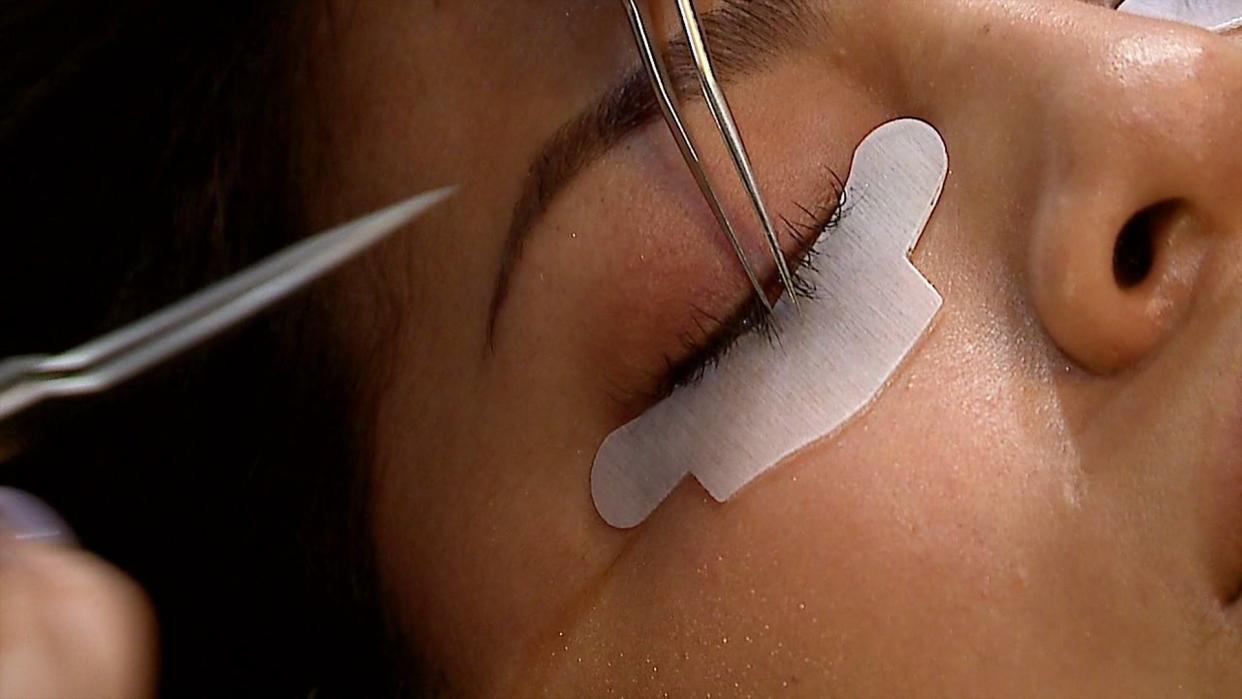 Eyelash Extensions Lead to Cosmetic Nightmare